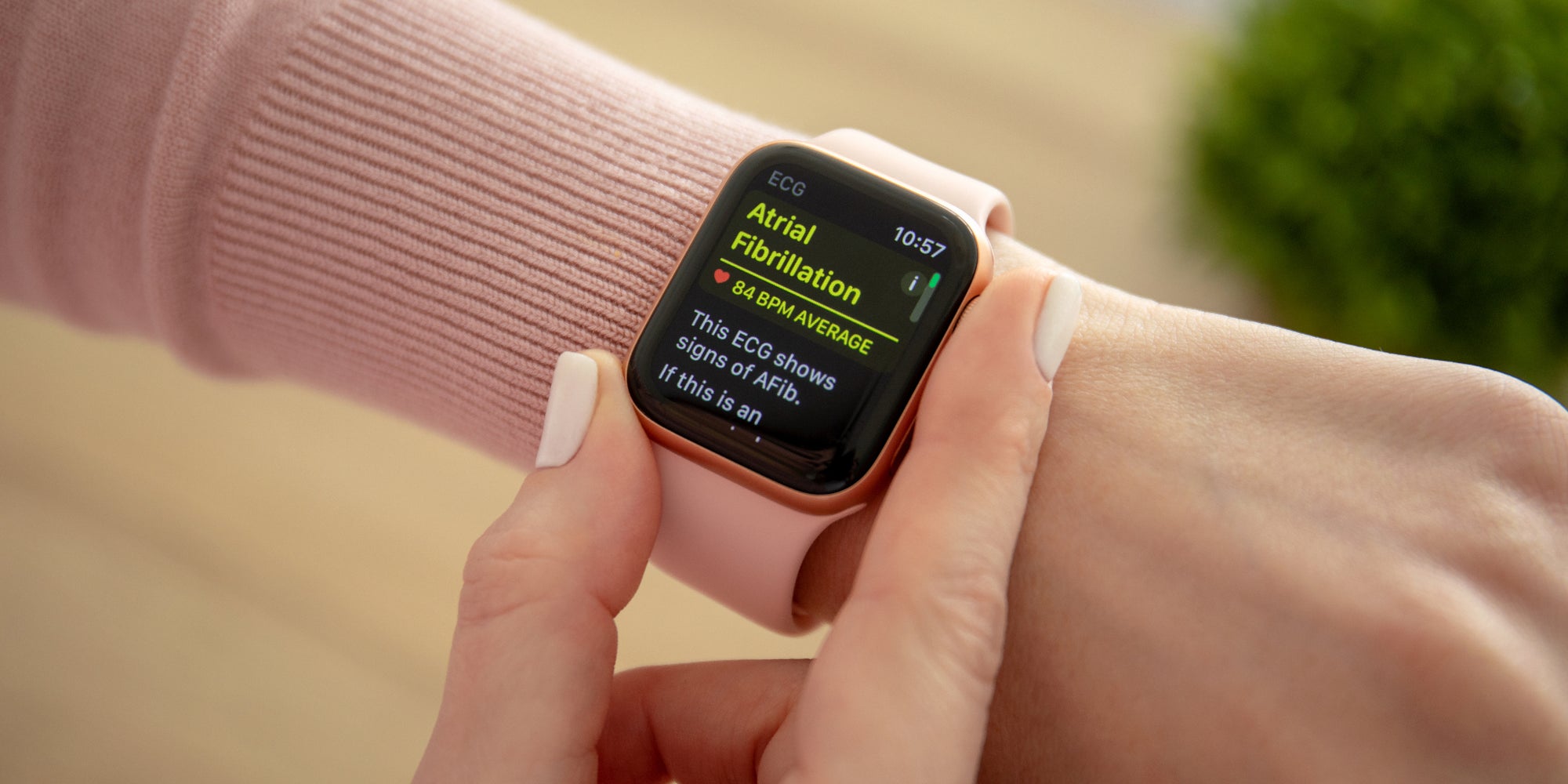Outre la très attendue Apple Watch Series 6, la marque à la pomme aurait aussi prévu une version "SE" de sa fameuse montre connectée...