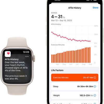 Santé+ : Apple s'apprête à transformer votre iPhone en médecin de poche