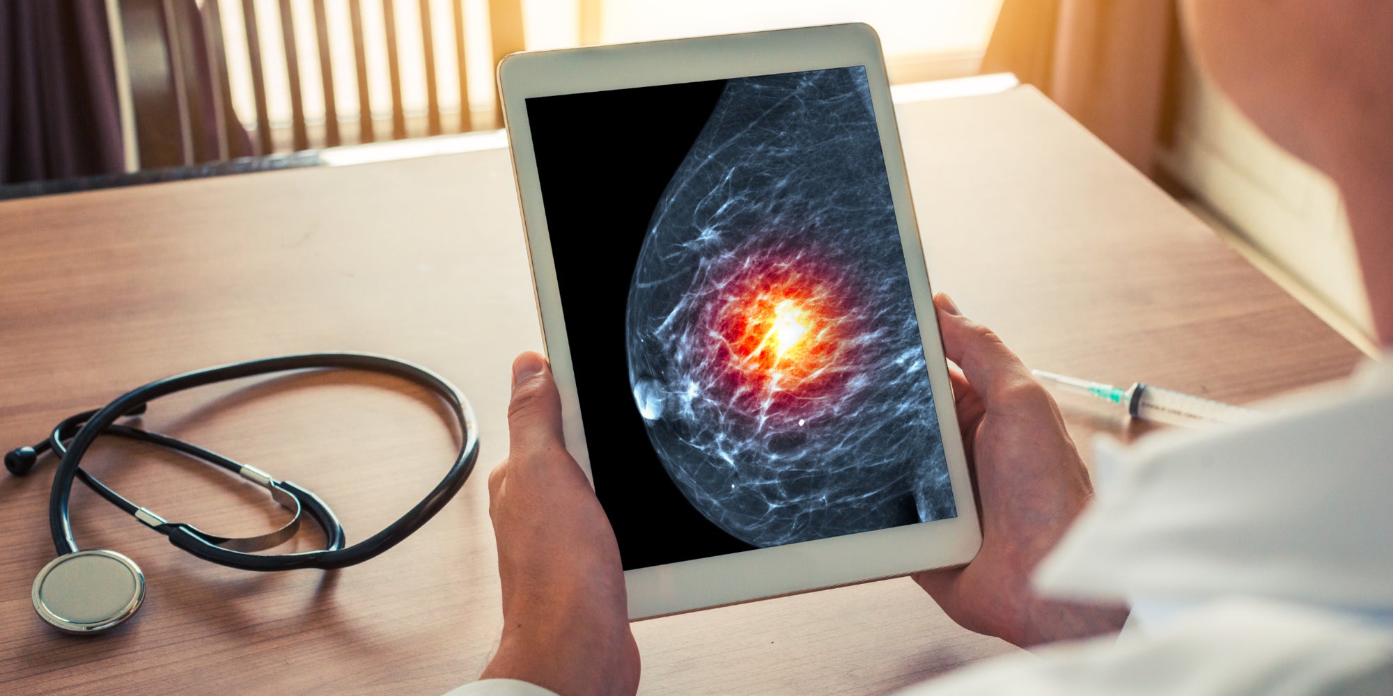 L'intelligence artificielle saurait mieux lire les mammographies que les spécialistes.