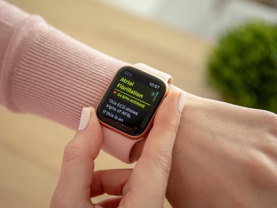 Bientôt deux nouvelles Apple Watch ?