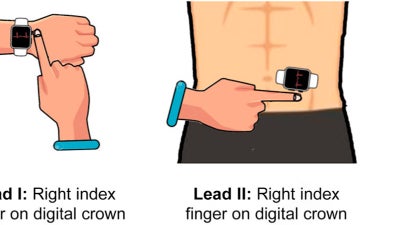 Comment utiliser l'Apple Watch pour effectuer un ECG plus précis